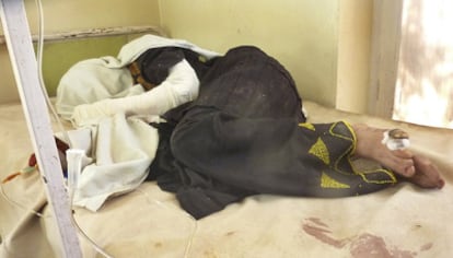 Una mujer herida tumbada en una cama del hospital de Azra.