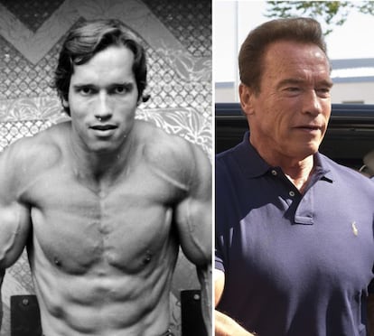 Arnold Schwarzenegger no ha hecho grandes cambios en su rostro, pero uno de los que más se le nota es su mandíbula. Aunque el actor no se ha sometido a muchas intervenciones, sí que es un adicto al bótox. Cada cierto tiempo el exgobernador de California (EE UU) intenta aplicarse la famosa toxina botulínica cosmética para esconder algunas arrugas.