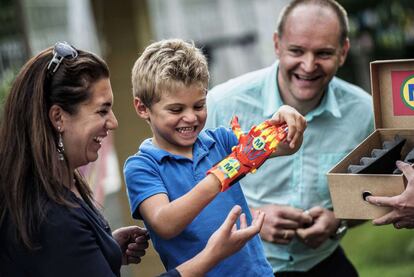 Un muchacho, que nació con una malformación den la mano derecha, se prueba su nueva mano impresa en 3D que le dió la 3D-impresa que le dio por la Asociación para el Estudio y la Asistencia a Niños Amputados (ASSEDEA).