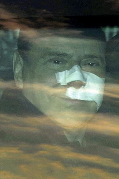 Berlusconi, tras recibir el jueves el alta del hospital en Milán.