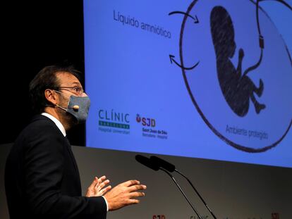 El director general de BCNatal, Eduard Gratacós, durante la presentación del proyecto de creación de una placenta artificial para salvar a bebés prematuros