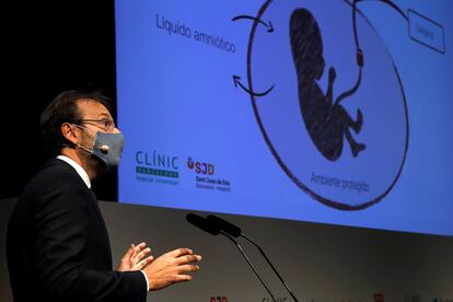 El director general de BCNatal, Eduard Gratacós, durante la presentación del proyecto de creación de una placenta artificial para salvar a bebés prematuros