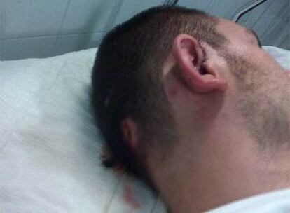 Uno de los futbolistas agredidos descansa en el hospital.