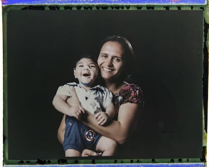 Rozilene Ferreira posa con su hijo de un año, Arthur Conceicao, nacido con microcefalia, en Recife (Brasil). Un año después del aumento en el número de recién nacidos con el defecto conocido como microcefalia, los médicos e investigadores brasileños han observado que muchos de los bebés desarrollan dificultades para tragar, convulsiones epilépticas y problemas de visión y audición.