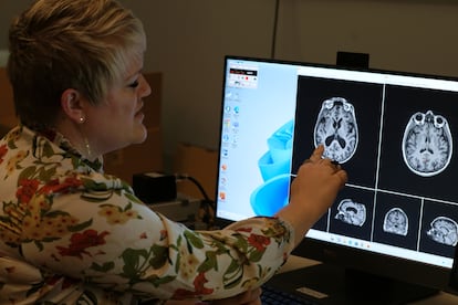 El estudio de Kelsey Baker ayudará a los médicos en el diagnóstico de la enfermedad de Parkinson y el tratamiento de sus pacientes.