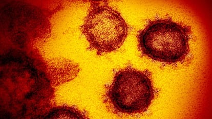 Imagen de microscopio del virus 2019-nCoV.