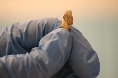 Los dientes son la parte del cuerpo que mejor se conserva en el registro fósil y desde hace unos años la metagenómica ayuda a identificar el microbioma oral del pasado. Este diente tiene 3.000 años.