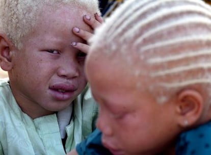 Niños albinos en Senegal.