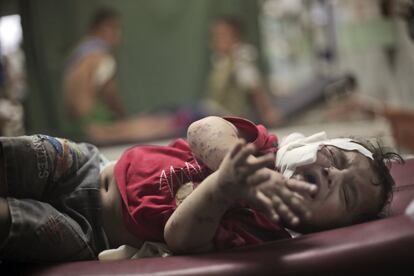 Un niño herido en el ataque a la escuela de la Onu el 30 de julio de 2014, llora mientras es atendido en un hospital.