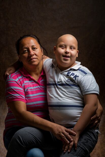 Jacqueline Sulbarán posa con su hijo Carlos, de 10 años. Carlos está curado de una Leucemia Linfoblástica Aguda Infantil (LLA), pero debe cumplir dos años de tratamiento para evitar una recaída. Sin embargo, los problemas económicos de sus padres han puesto en pausa ese tratamiento. "A veces él me pregunta por qué no tiene cabello. Yo le digo que es porque su papá lo quiere ver con el mismo corte de cabello que él. Mi esposo se quitó todo el cabello también", cuenta Jaqueline.