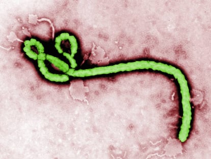 Imagen del virus del ébola a través de microscopio