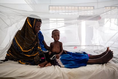 En una visita a la clnica mvil en el campo de desplazados internos de Luglow, le dijeron a Haawo Abass (20 a?os) que llevara a su hijo Abdelnasr al centro de recuperacin en Kismayo. El ni?o sufre de kwashiorkor, un tipo de desnutricin proteica que provoca una afeccin de la piel que se manifiesta en cambios en la pigmentacin de la piel. La enfermedad es tpica del perodo de destete y afecta sobre todo a ni?os en su segundo a?o de vida. Abdelnasr tiene 16 meses.