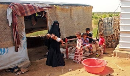 Hashem Mahmoud Atin, un niño yemení desplazado de diez meses que sufre de desnutrición aguda y que no puede llegar a un hospital para recibir tratamiento, es retenido por su madre en un campamento en Abs, en la provincia de Hajjah, en el norte de Yemen, el 3 de septiembre de 2020. Cientos de niños y mujeres embarazadas se han visto afectados negativamente por el cierre de clínicas médicas financiadas por el Fondo de las Naciones Unidas para la Infancia (UNICEF) en los campamentos de desplazados de Yemen.