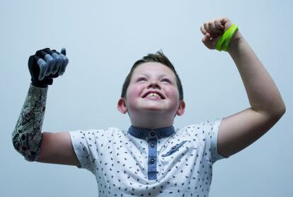 Josh Cathcart, ayer en la sede la empresa Touch Bionics, en Escocia, donde le fue colocado un brazo biónico.