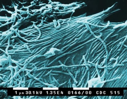 Imagen al microscopio de partículas víricas de ébola.