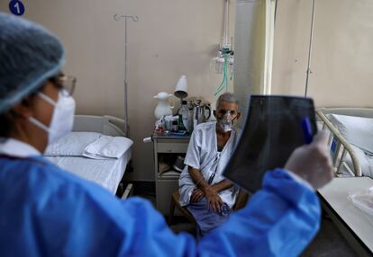 Un médico mira una prueba de rayos X de un enfermo de coronavirus en un hospital de Nueva Delhi. 
