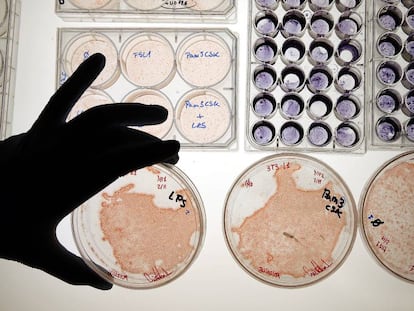 Placas de Petri con cultivos de células.