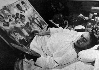 Frida Kahlo pasó buena parte de su vida postrada en una cama, padeciendo constantemente horribles dolores tras su accidente.