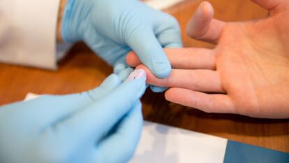 Realización de una prueba rápida para detectar el VIH en sangre.
