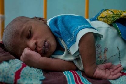 Issa, de dos semanas, fue alimentado con leche de cabra porque su madre murió en el parto y su familia no tenía otro alimento para él.