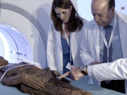 Un estudio del Museo Arqueológico Nacional y el Hospital QuirónSalud somete a cuatro cadáveres embalsamados a un TAC para conocer sus secretos