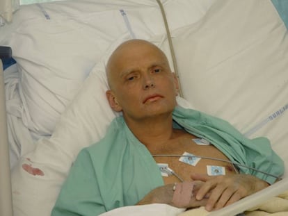 El agente Alexander Litvinenko tras ser intoxicado con polonio 2010. 