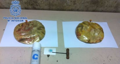 The implants that were taken out of the woman.