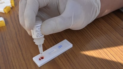 Aplicación de la Prueba Rápida de Detección del VIH, en enero 2018.