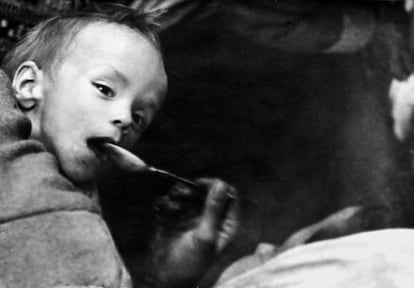 1946, Grecia. Un niño con malnutrición severa es alimentado con una cuchara.