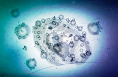 El aislamiento de las células madre, por Ann Tsukamoto

Ann Tsukamoto forma parte del equipo que consiguió una patente en 1991 por el proceso de aislamiento de células madre humanas. Gracias a su trabajo podría avanzarse en la cura contra el cáncer.