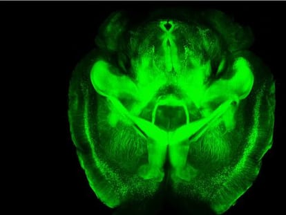 Un equipo multidisciplinar de la Universidad de Stanford ha desarrollado un método para estudiar el cerebro sin alterar su forma ni conexiones internas.