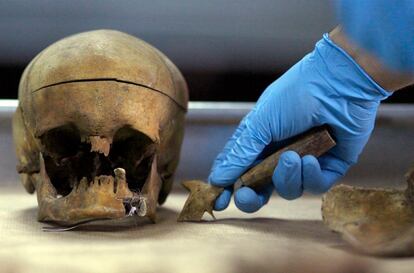 Un médico forense examina los huesos de una víctima de la masacre de Srebrenica en 1995. Fotografía tomada el 16 de junio de 2008.