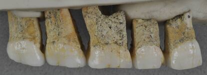 Os dentes de ‘Homo luzonensis’ encontrados na caverna de Callao (Filipinas).