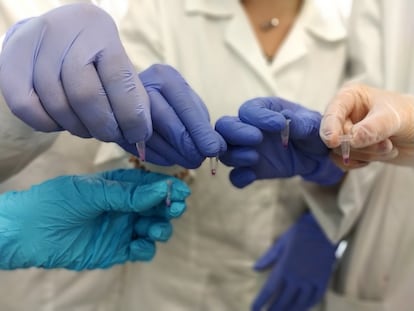 Alumnas del grado superior de FP de Anatomía Patológica y Citodiagnóstico, del IES Moratalaz (Madrid), en un proyecto de CaixaBank Dualiza y la empresa Genyca.