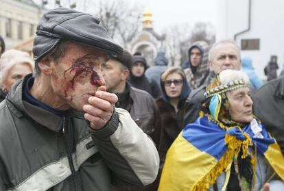 Un herido en la dispersión de la protesta, en Kiev.