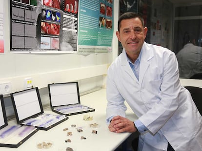 El odontólogo José Luis Calvo Guirado, en la Universidad Católica de Murcia, en 2016.