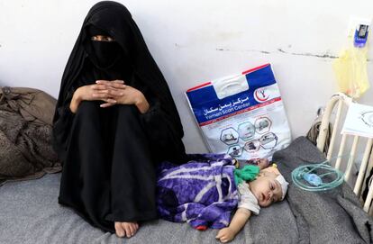 Una madre yemení, junto a su hijo desnutrido, este viernes en Saná.