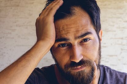 La caída de pelo estacional se debe a una alteración del ciclo de crecimiento del cabello. Sin embargo, según los expertos, "casi todos los que caen en otoño se recuperan y reaparecerán al cabo de tres o cuatro meses, tanto si tomamos suplementos de vitaminas como si no".