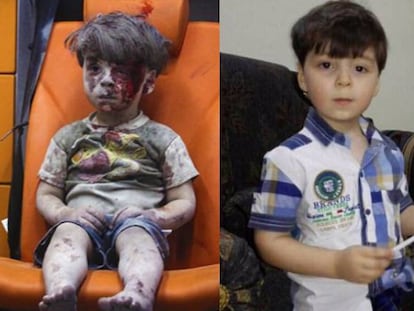 O menino sírio Omran, quase um ano depois do bombardeio de Aleppo