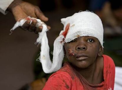 Un niño herido en el terremoto de Haití.