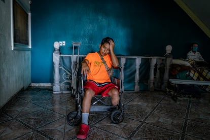 Evert Rodríguez, migrante hondureño, descansa en el albergue para migrantes amputados ubicado en Celaya, Guanajuato, el 14 de julio de 2022.