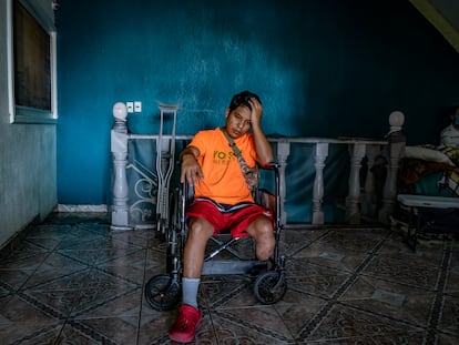 Evert Rodríguez, migrante hondureño, descansa en el albergue para migrantes amputados ubicado en Celaya, Guanajuato, el 14 de julio de 2022.