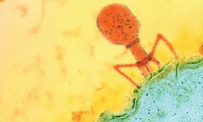 Mycobacterium chelonae