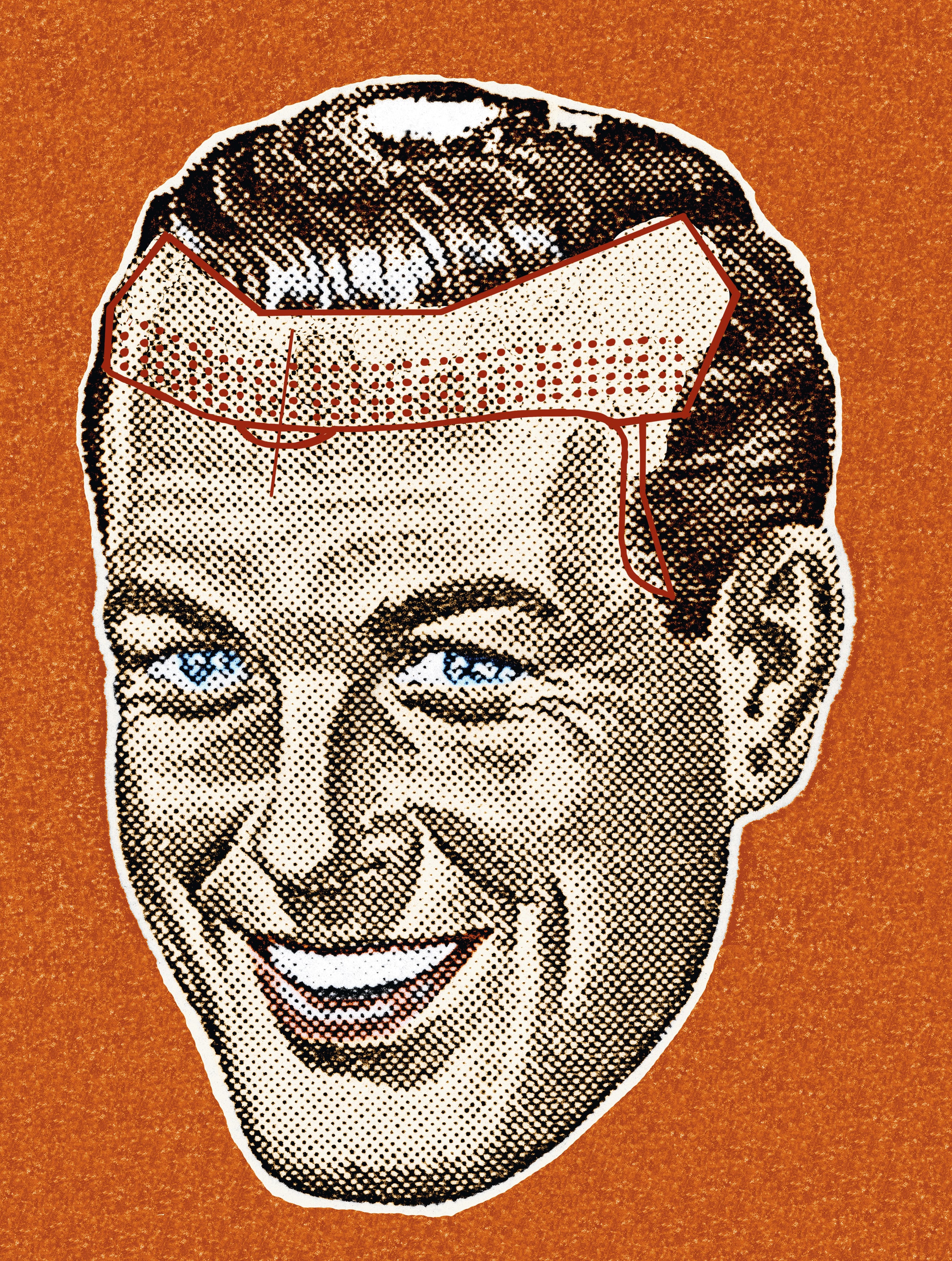 ¿Por qué tantos implantes capilares anulan las entradas? “Hacerlas desaparecer es perder identidad”