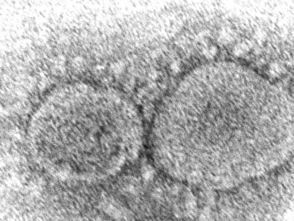 This 2020 electron microscope image made available by the Centers for Disease Control and Prevention shows SARS-CoV-2 virus particles, which cause COVID-19.