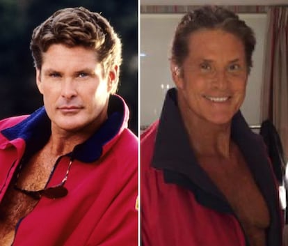 El actor David Hasselhoff, conocido por su papel en las series 'El coche fantástico' y 'Los vigilantes de la playa', no deja dudas sobre su cambio. Con tal de lucir joven, el intérprete ha entrado en el quirófano en varias ocasiones. Se ha retocado los párpados, así como ha acentuado su mentón. Y para intentar ocultar sus arrugas Hasselhoff ha caído en la tentación del bótox.