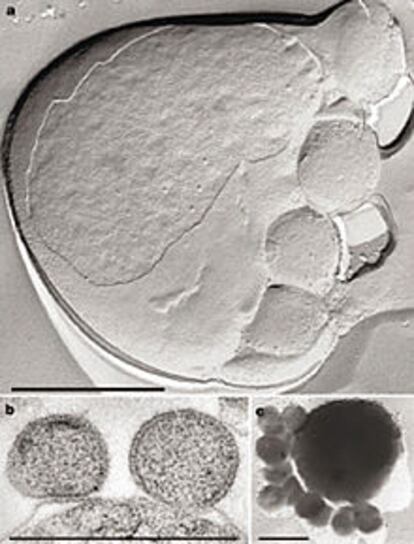 Arriba, imagen al microscopio electrónico de cuatro <b></b><i>nanoarqueas</i> pegadas al costado derecho de una célula de <b></b><i>Ignicoccus. </i>Abajo, a la izquierda, se aprecia que las <b></b><i>nanoarqueas</i> no llegan a fundirse con el <b></b><i>Ignicoccus,</i> aunque se peguen a él.