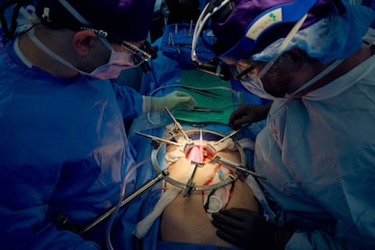 Experimentos personas muerte cerebral