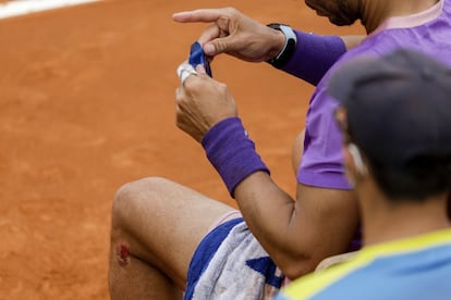 Tras la caída, Nadal sufrió una quemadura a la altura de la rodilla, en el lateral de la articulación.