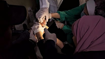 Personal sanitario atiende a un palestino herido por un ataque israelí, utilizando una linterna debido al corte de energía en el hospital Indonesio del norte de la Franja, el día 10 de noviembre.